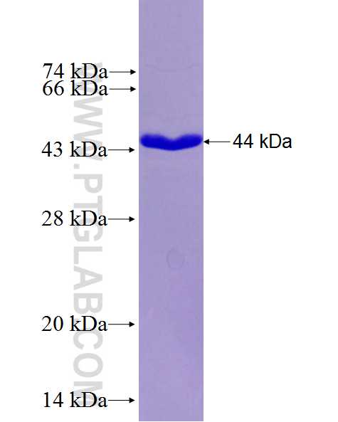 RNF139 fusion protein Ag27147 SDS-PAGE