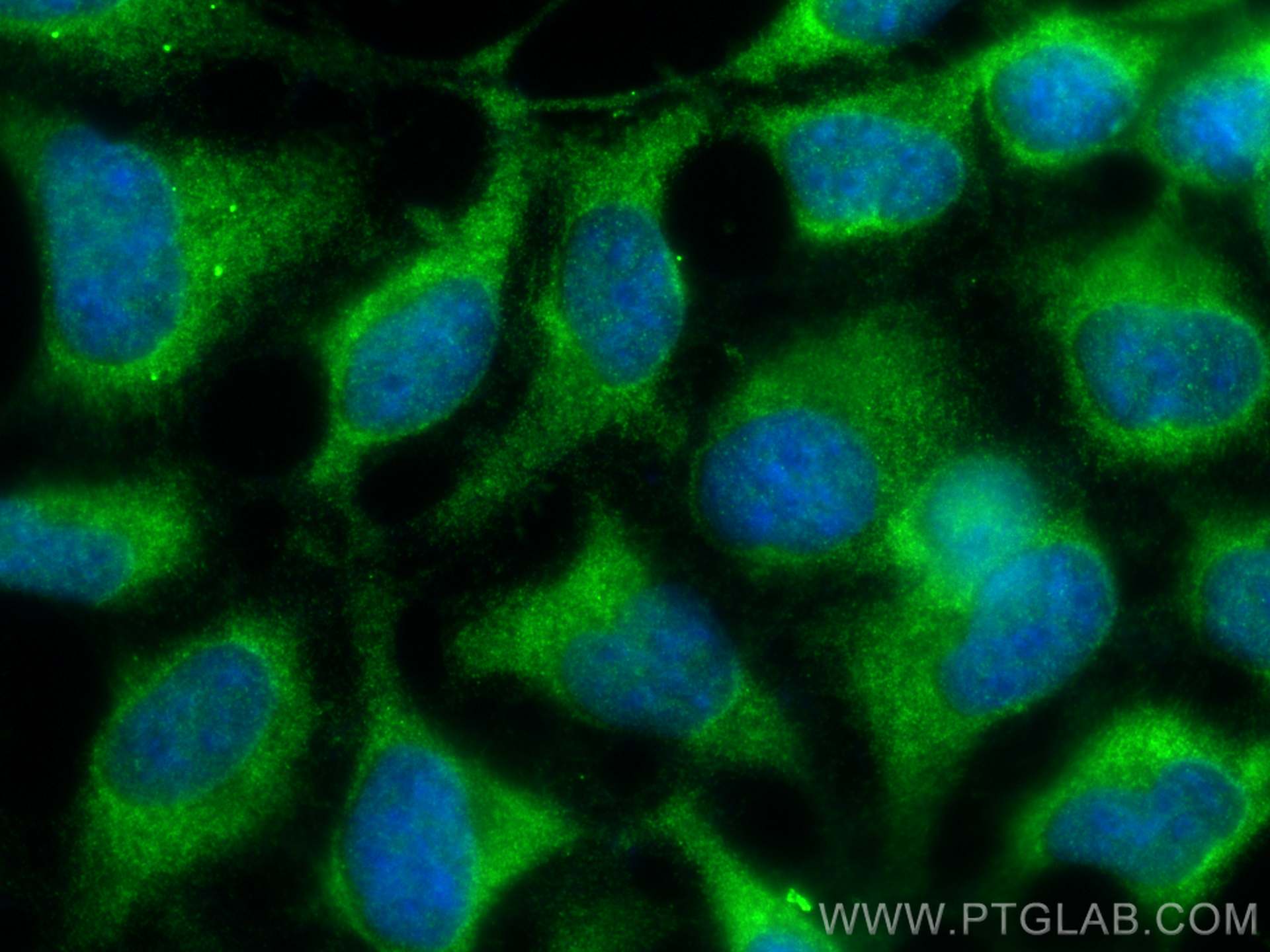 Immunofluorescence (IF) / fluorescent staining of HEK-293 cells using RNF14 Polyclonal antibody (26368-1-AP)