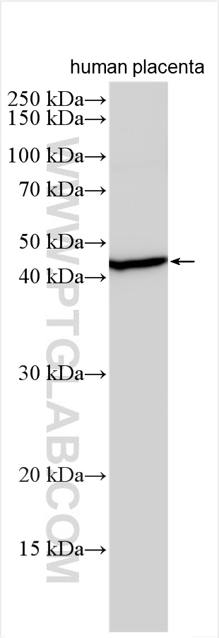 Western Blot (WB) analysis of various lysates using RNF146 Polyclonal antibody (23927-1-AP)