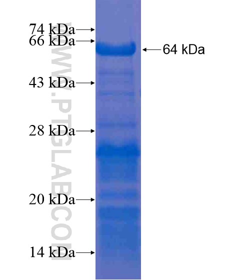 RNF146 fusion protein Ag20999 SDS-PAGE