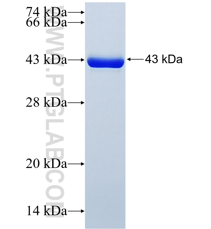 RNF160 fusion protein Ag29471 SDS-PAGE