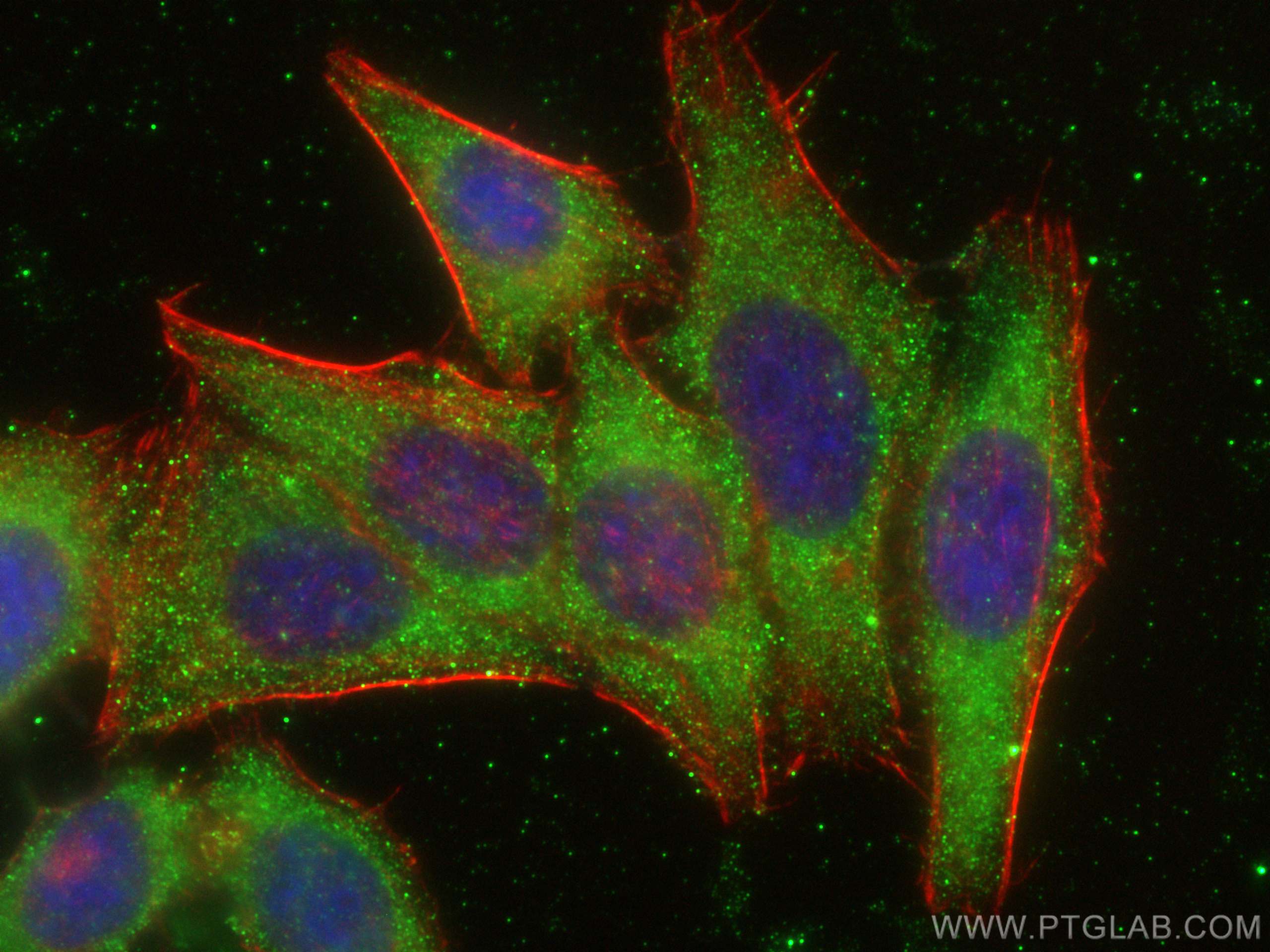 Immunofluorescence (IF) / fluorescent staining of HepG2 cells using RNF181 Polyclonal antibody (20408-1-AP)