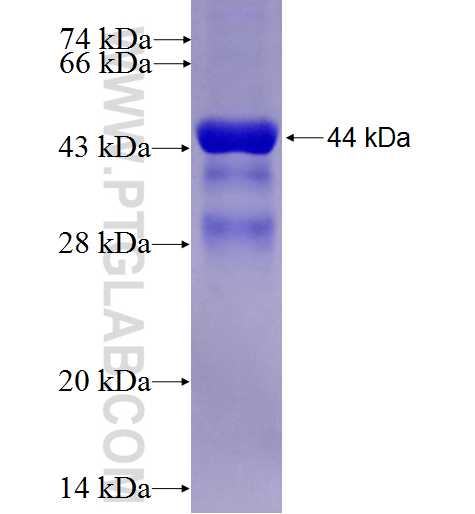 RNF182 fusion protein Ag27390 SDS-PAGE