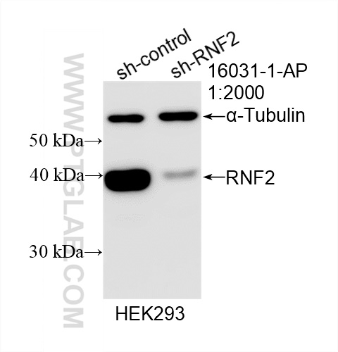 Western Blot (WB) analysis of HEK-293 cells using RNF2 Polyclonal antibody (16031-1-AP)