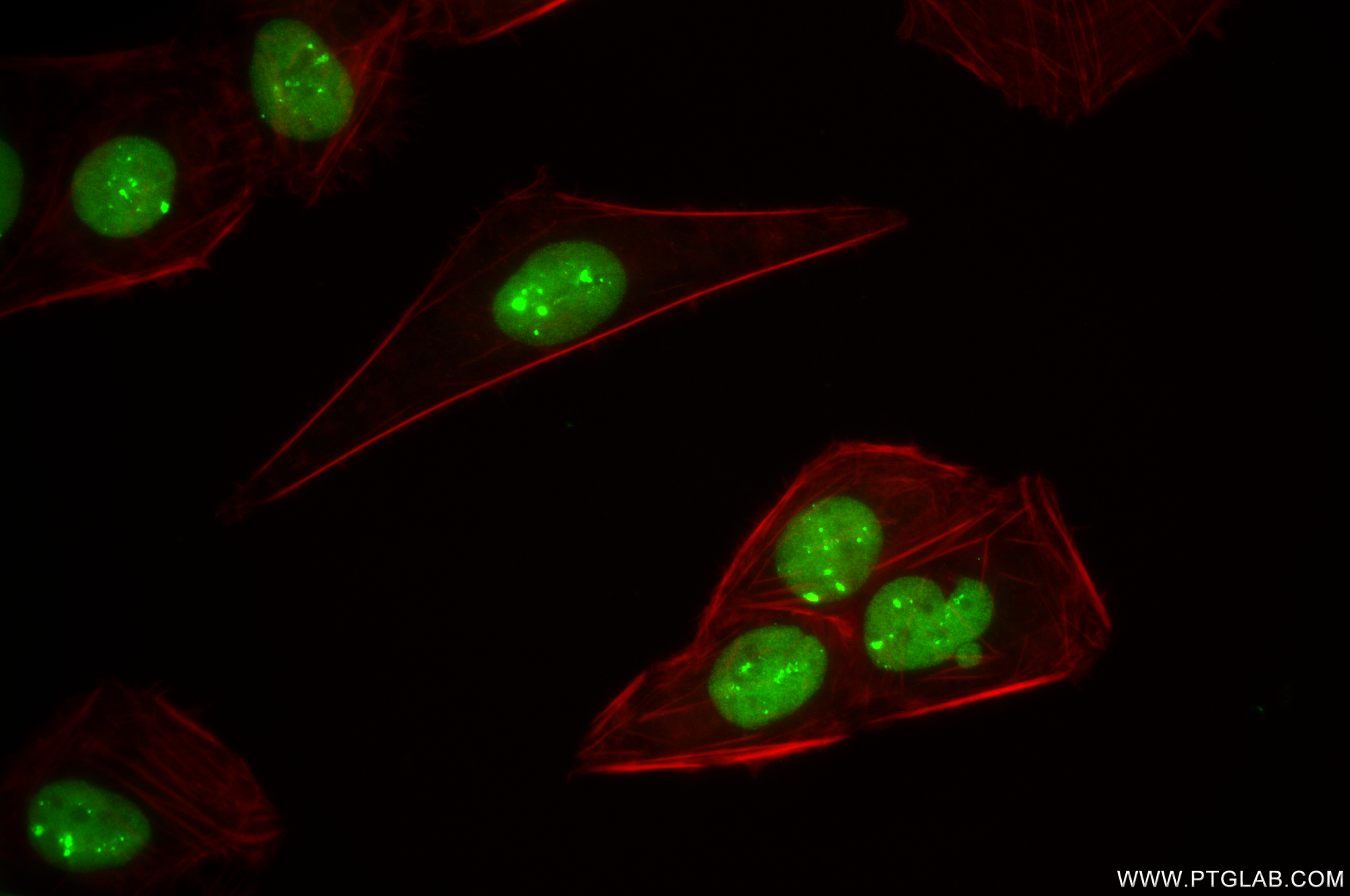 Immunofluorescence (IF) / fluorescent staining of U2OS cells using RNF2 Recombinant antibody (84793-5-RR)