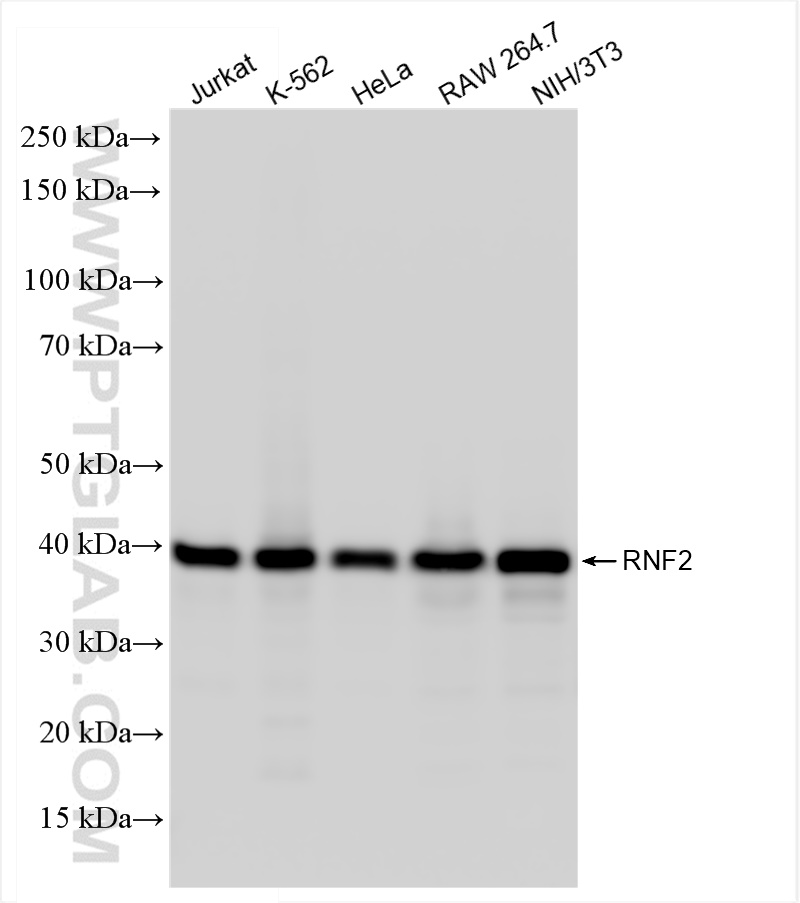 Western Blot (WB) analysis of various lysates using RNF2 Recombinant antibody (84793-5-RR)