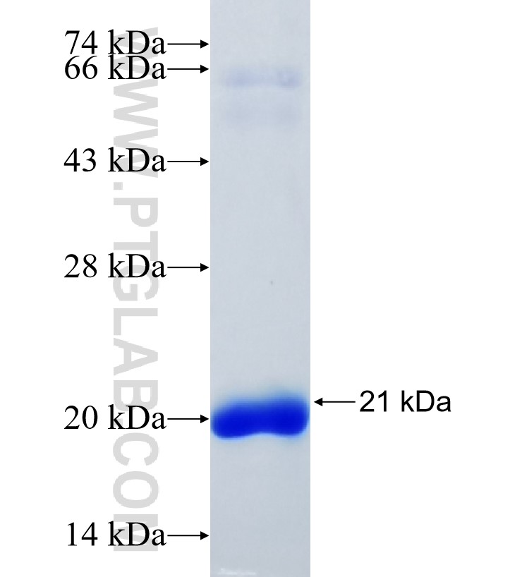 RNF212 fusion protein Ag31804 SDS-PAGE