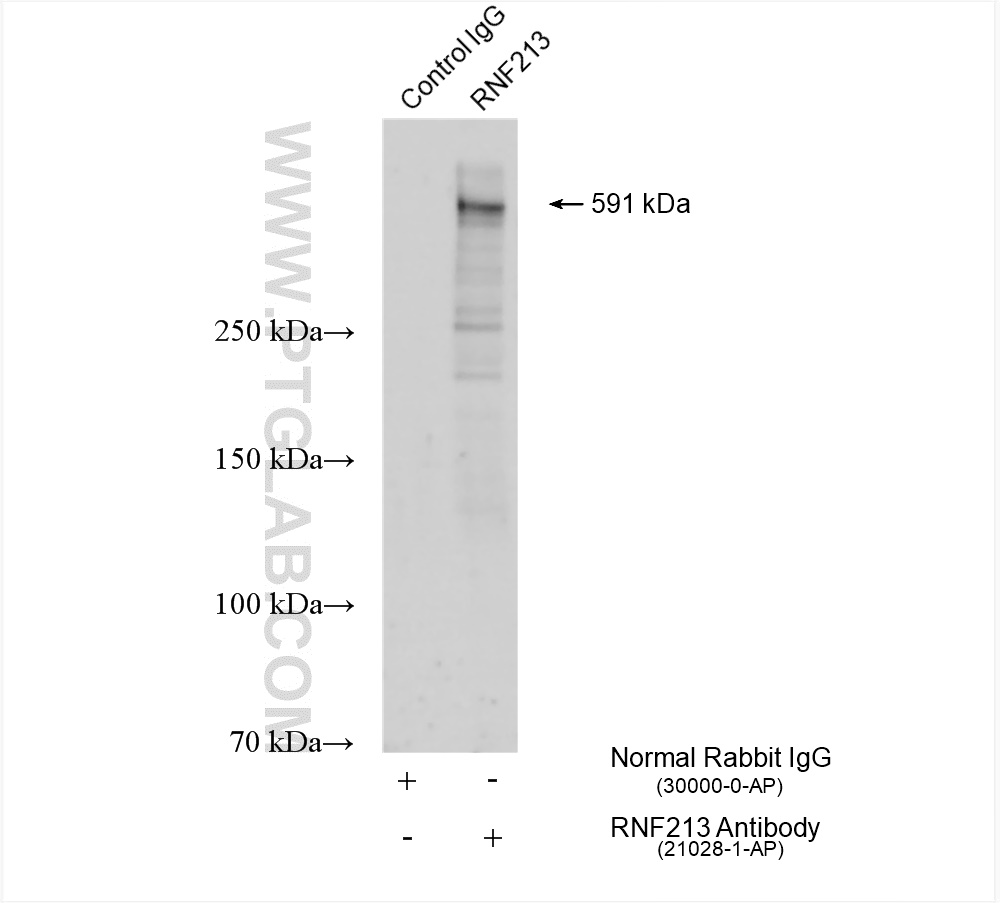 Immunoprecipitation (IP) experiment of HUVEC cells using RNF213 Polyclonal antibody (21028-1-AP)