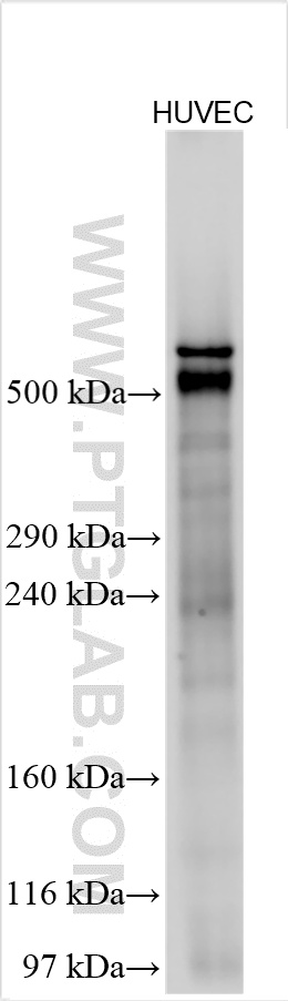 Western Blot (WB) analysis of various lysates using RNF213 Polyclonal antibody (21028-1-AP)