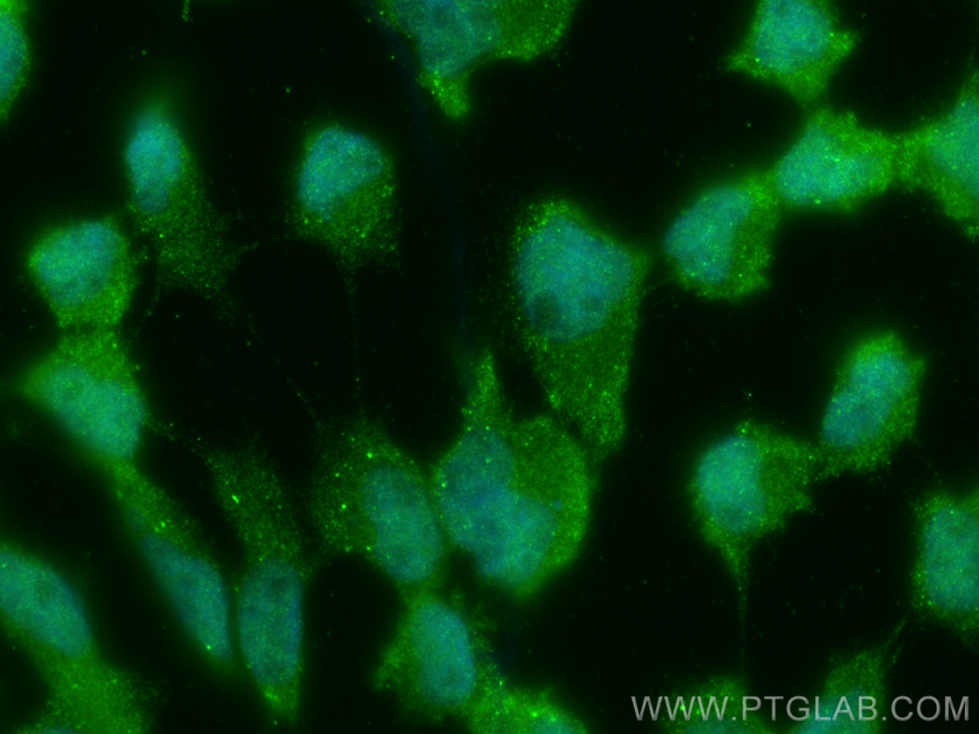 Immunofluorescence (IF) / fluorescent staining of A431 cells using RNF216 Polyclonal antibody (10185-1-AP)