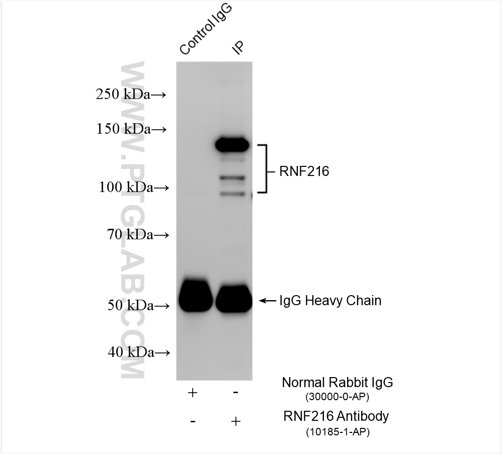 Immunoprecipitation (IP) experiment of SW480 cells using RNF216 Polyclonal antibody (10185-1-AP)