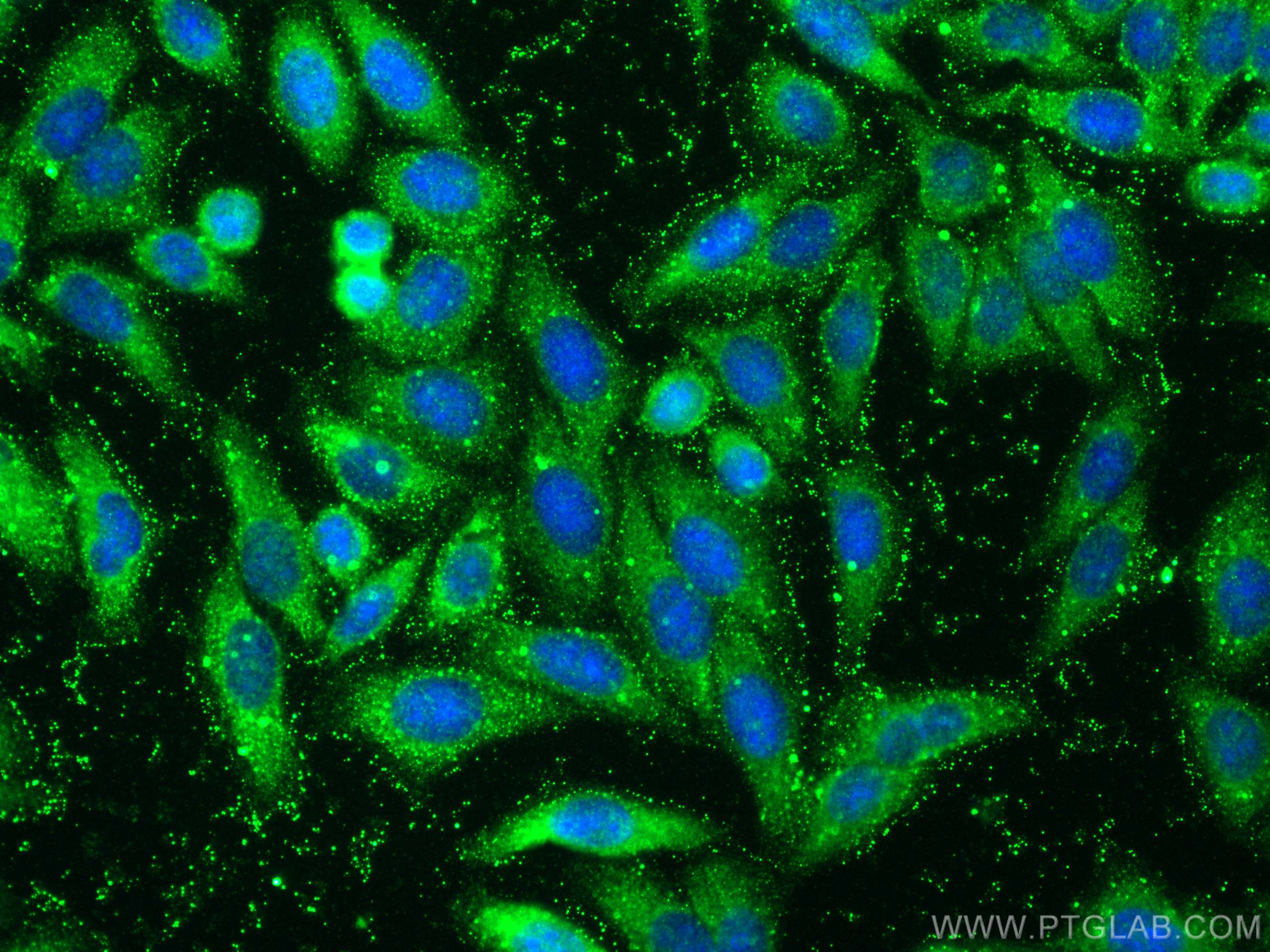 Immunofluorescence (IF) / fluorescent staining of HepG2 cells using RNF31 / HOIP Polyclonal antibody (30797-1-AP)