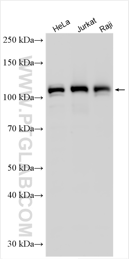 Western Blot (WB) analysis of various lysates using RNF31 / HOIP Polyclonal antibody (30797-1-AP)