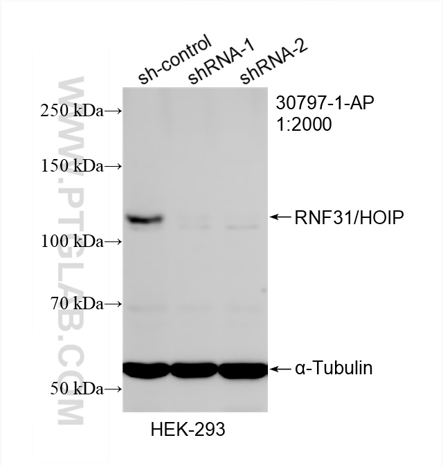 Western Blot (WB) analysis of HEK-293 cells using RNF31 / HOIP Polyclonal antibody (30797-1-AP)