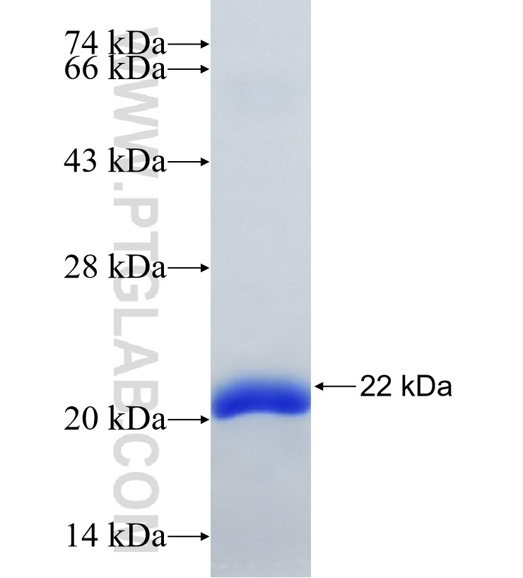 RNF31 fusion protein Ag34426 SDS-PAGE
