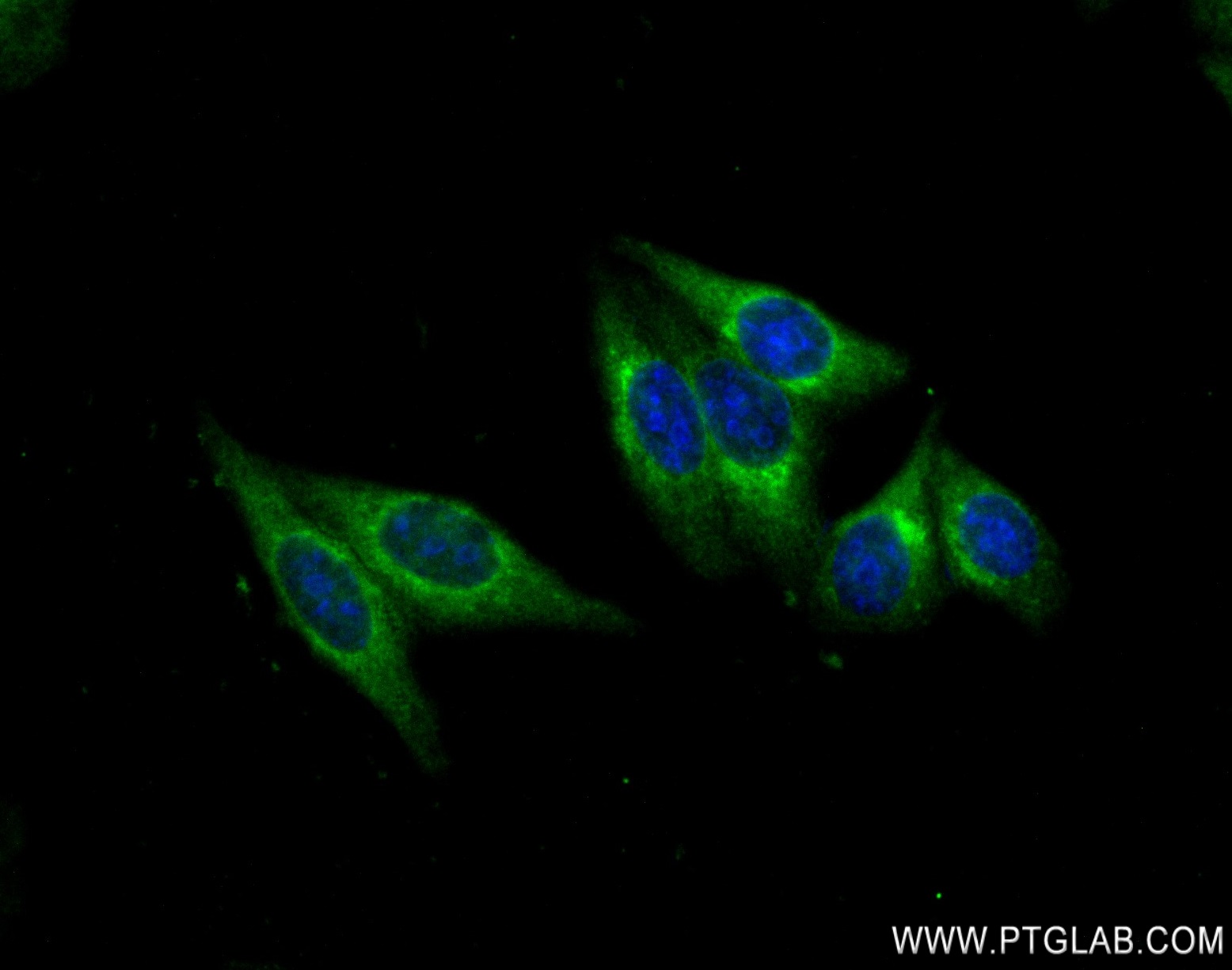 Immunofluorescence (IF) / fluorescent staining of HepG2 cells using RNF31 / HOIP Recombinant antibody (83137-3-RR)