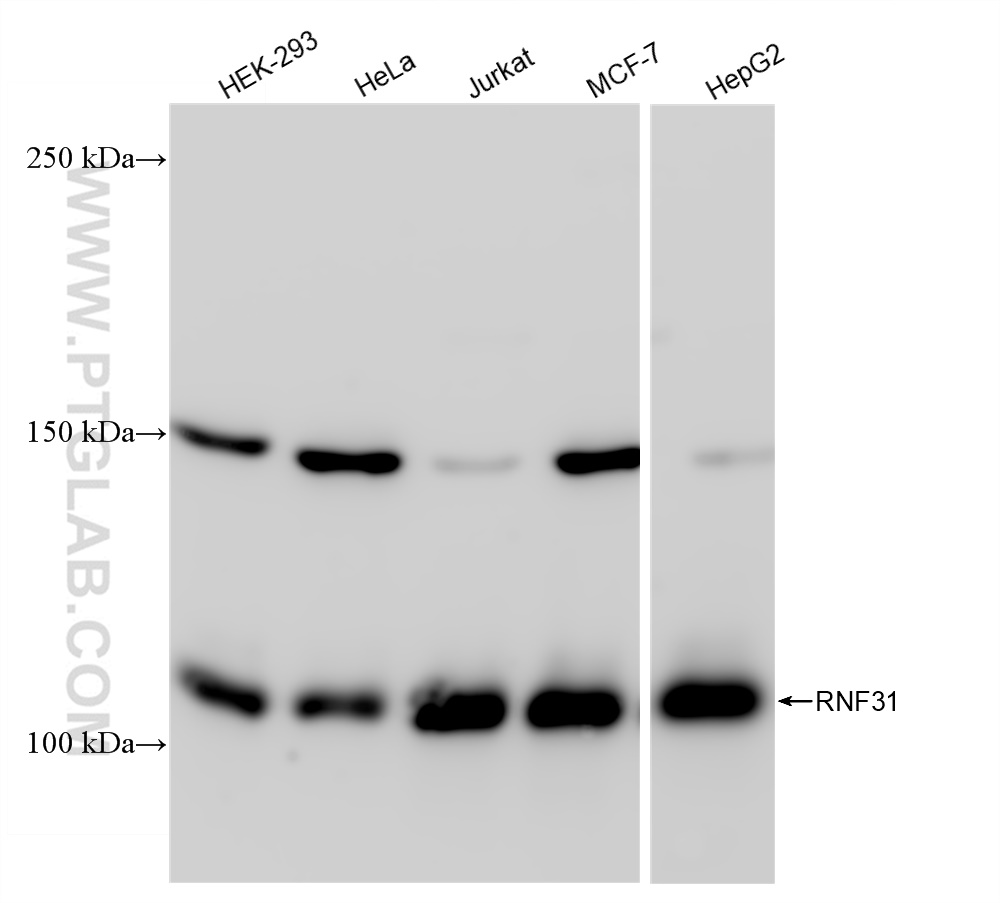 Western Blot (WB) analysis of various lysates using RNF31 / HOIP Recombinant antibody (83137-4-RR)