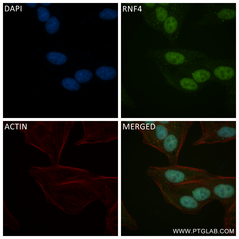 Immunofluorescence (IF) / fluorescent staining of HepG2 cells using RNF4 Recombinant antibody (84770-1-RR)