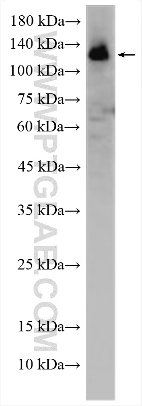 Western Blot (WB) analysis of HEK-293 cells using RNF40 Polyclonal antibody (15621-1-AP)