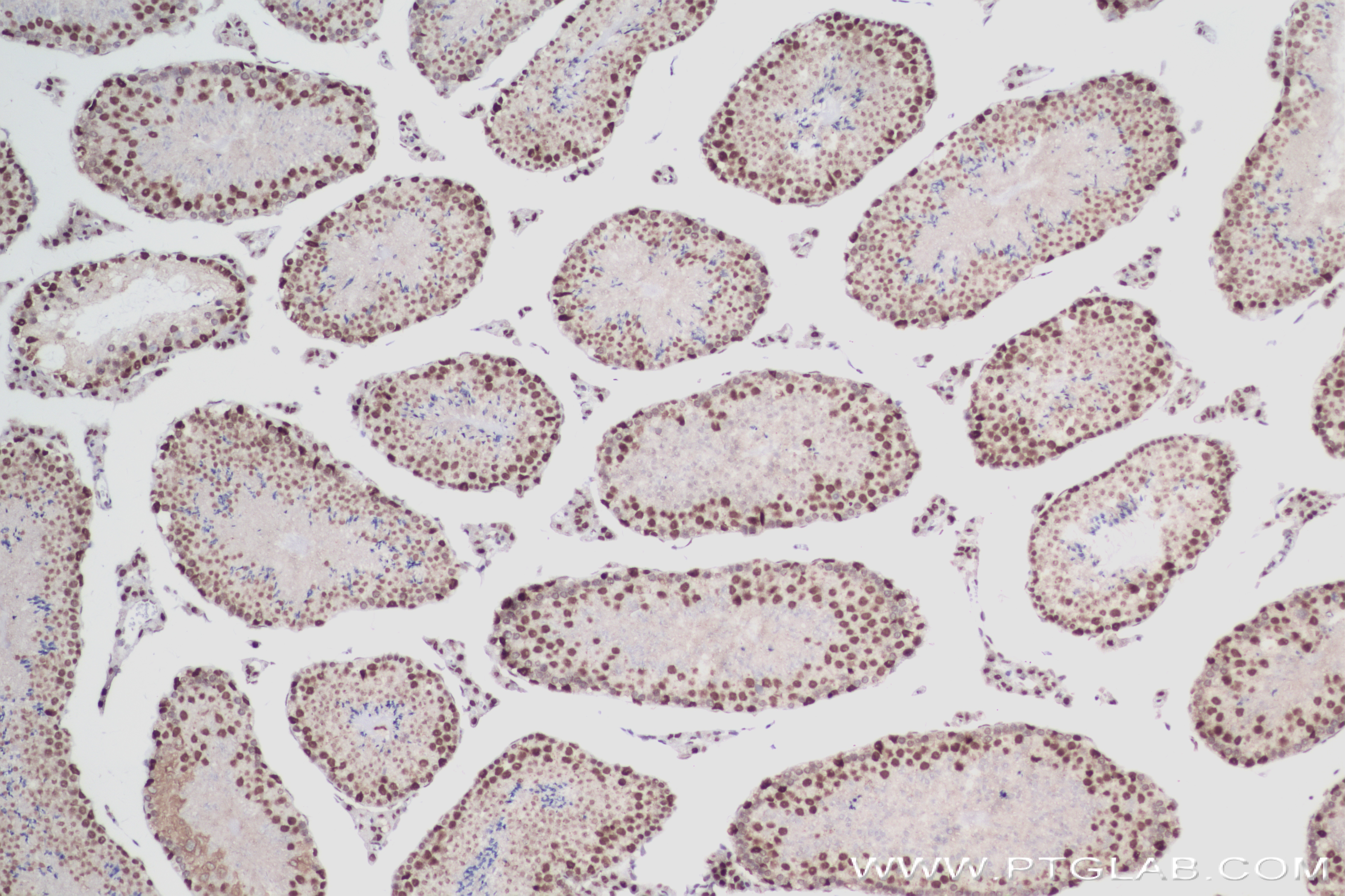 Immunohistochemistry (IHC) staining of mouse testis tissue using RNF40 Recombinant antibody (84058-4-RR)