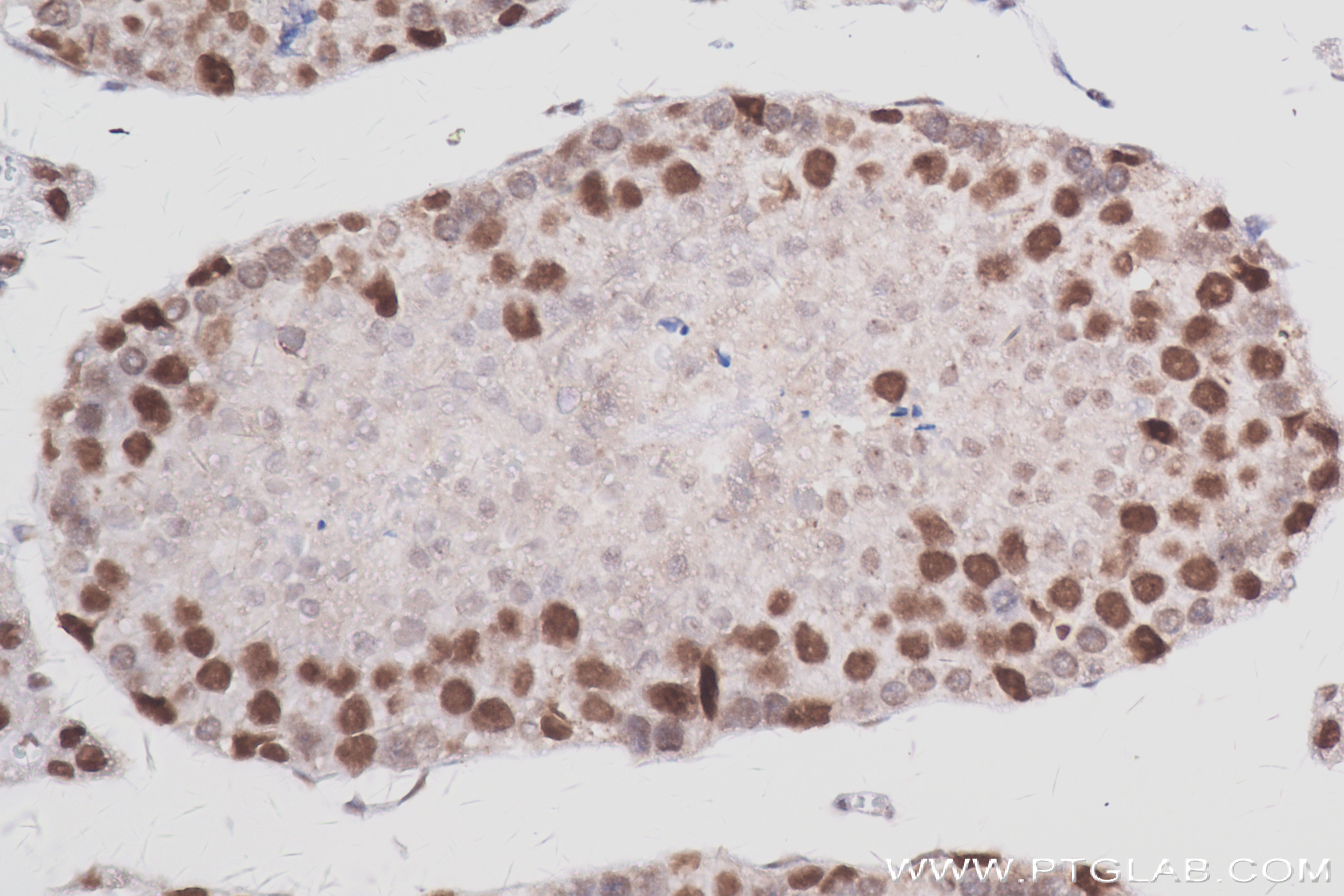 Immunohistochemistry (IHC) staining of mouse testis tissue using RNF40 Recombinant antibody (84058-4-RR)