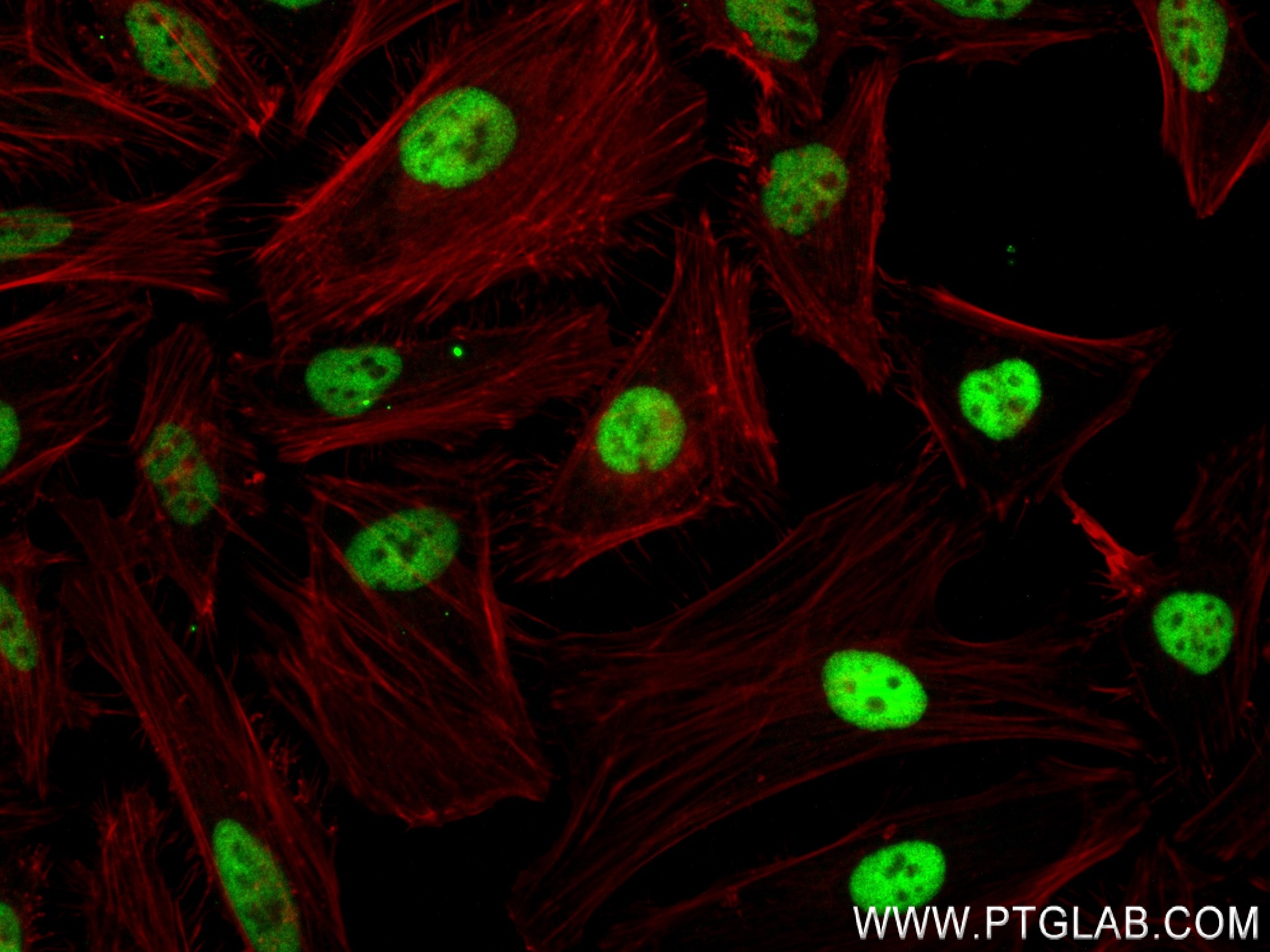 Immunofluorescence (IF) / fluorescent staining of HeLa cells using RNF40 Recombinant antibody (84058-5-RR)