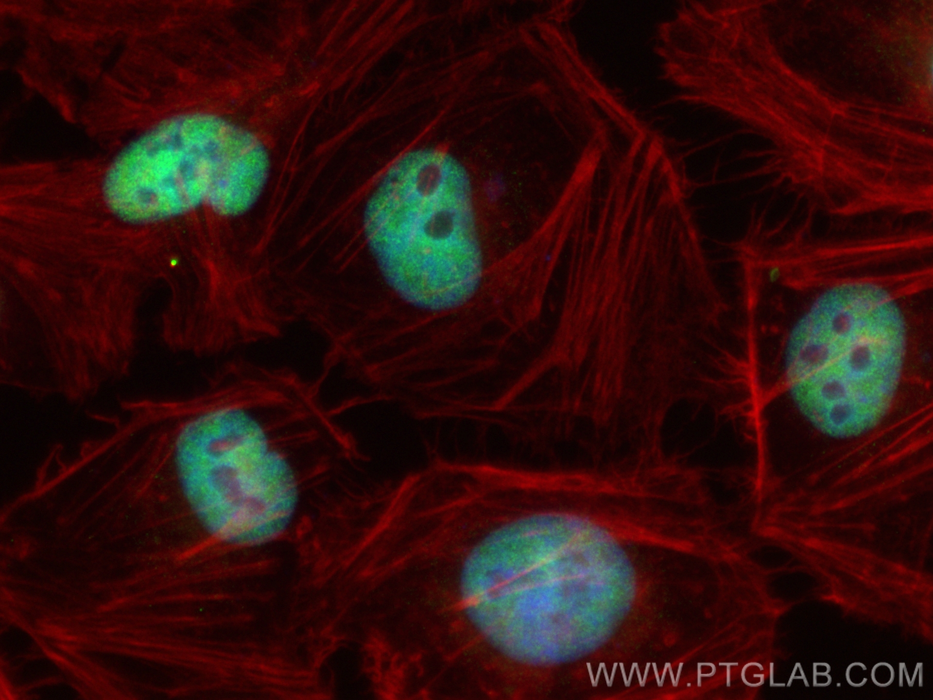 Immunofluorescence (IF) / fluorescent staining of HeLa cells using CoraLite® Plus 488-conjugated RNF40 Recombinant an (CL488-84058-5)