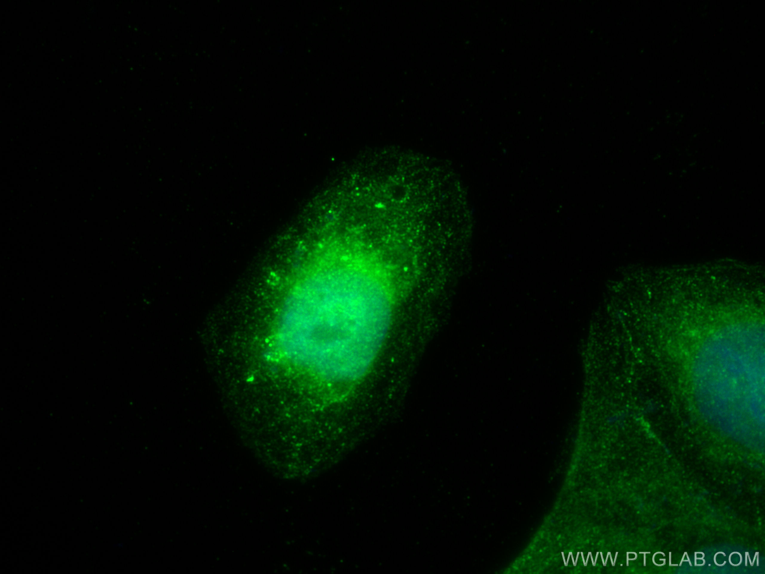 Immunofluorescence (IF) / fluorescent staining of U2OS cells using RNF7 Polyclonal antibody (11905-1-AP)