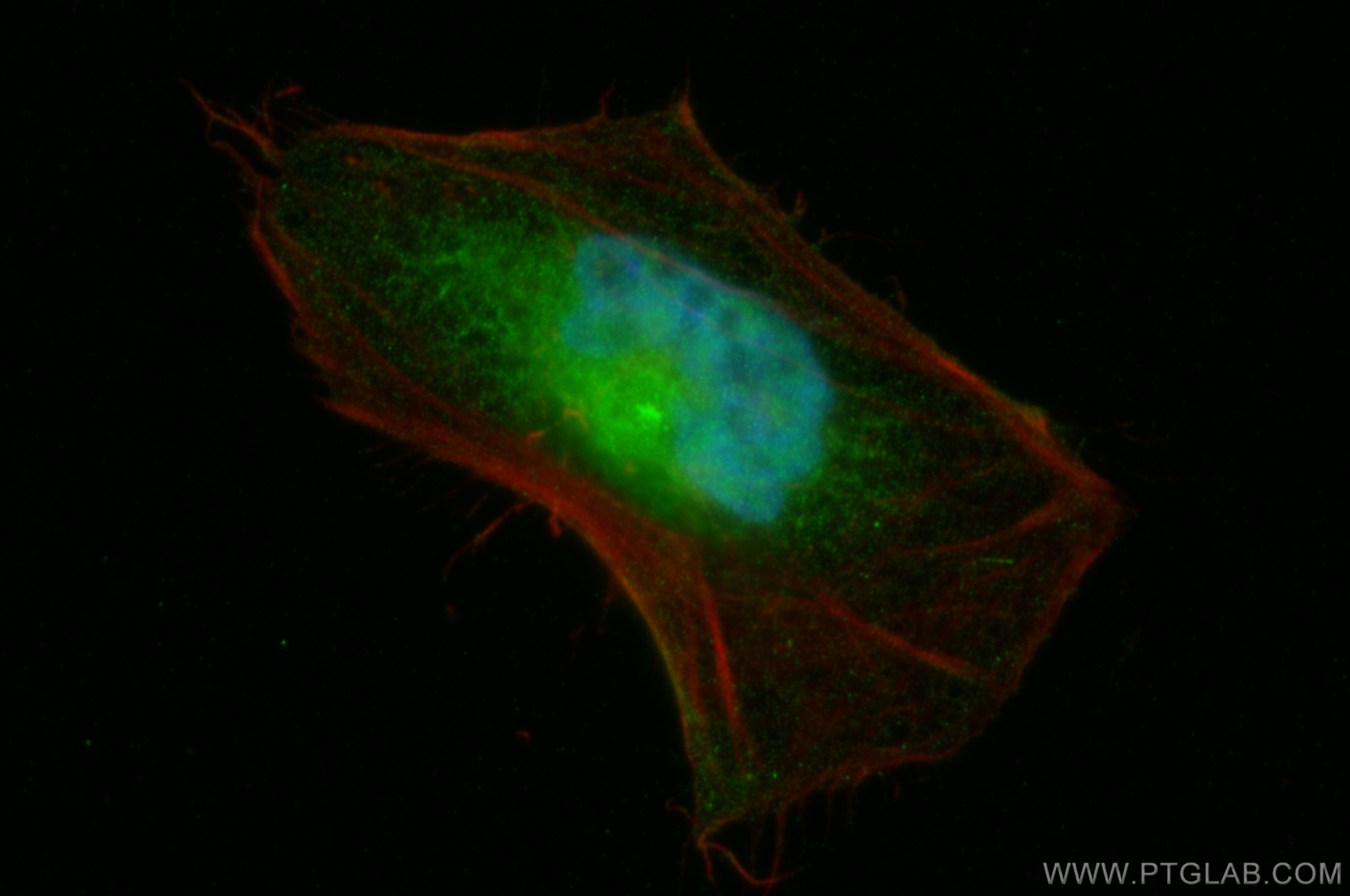 Immunofluorescence (IF) / fluorescent staining of HeLa cells using RNF8 Polyclonal antibody (14112-1-AP)