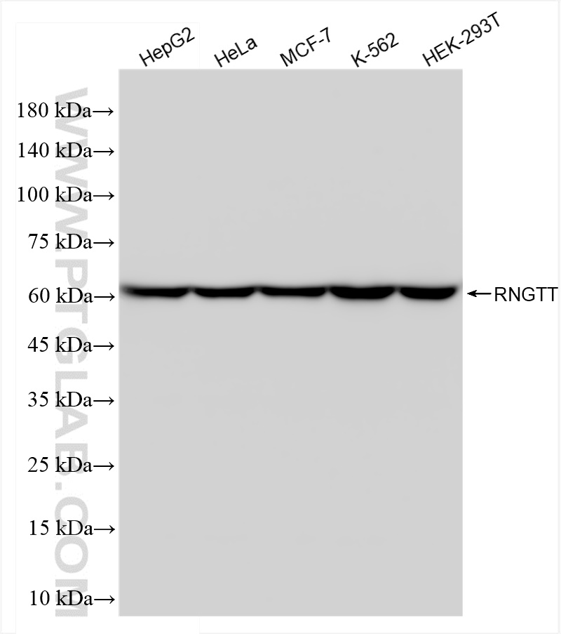 Western Blot (WB) analysis of various lysates using RNGTT Recombinant antibody (83974-2-RR)