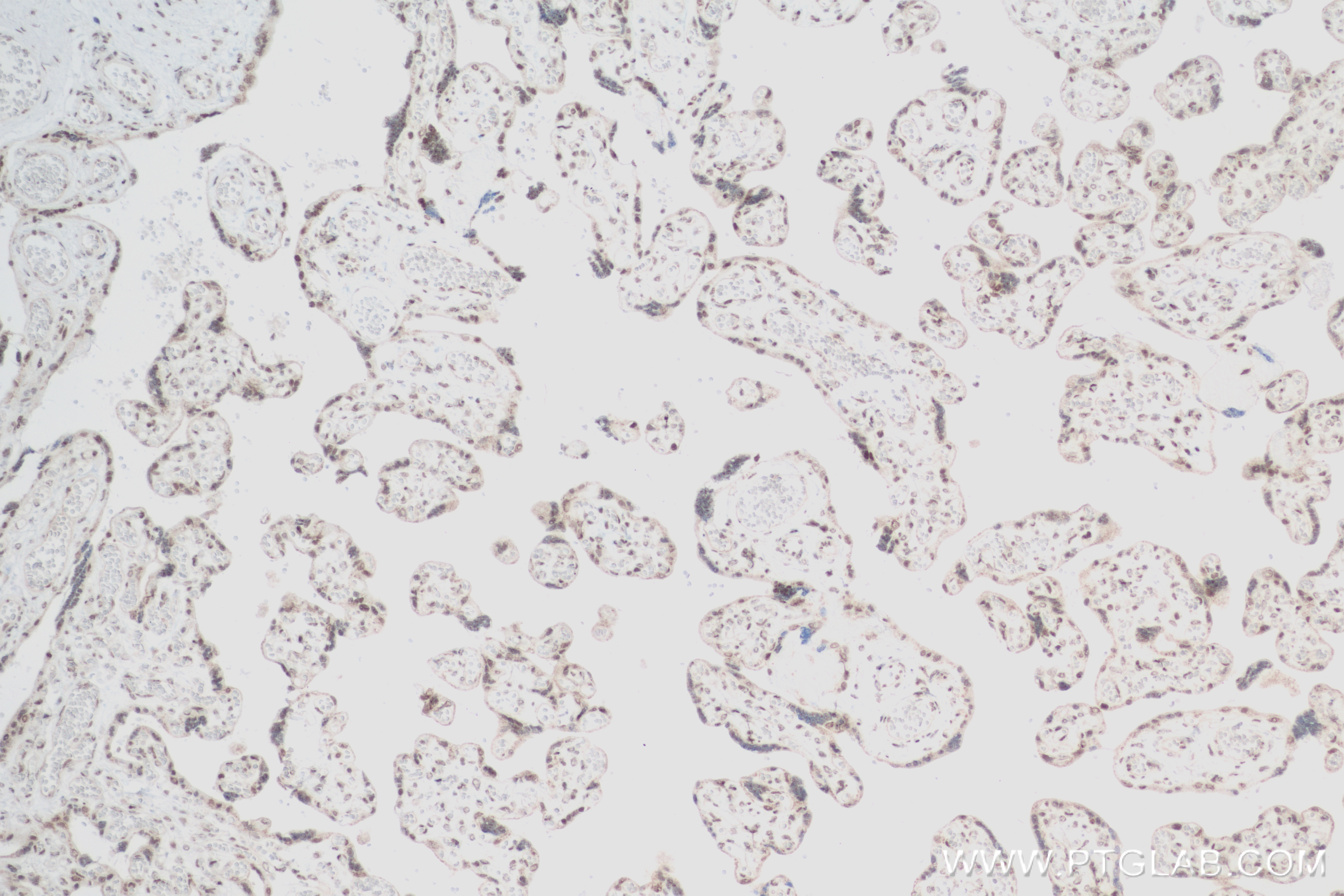 Immunohistochemistry (IHC) staining of human placenta tissue using RNGTT Recombinant antibody (83974-4-RR)