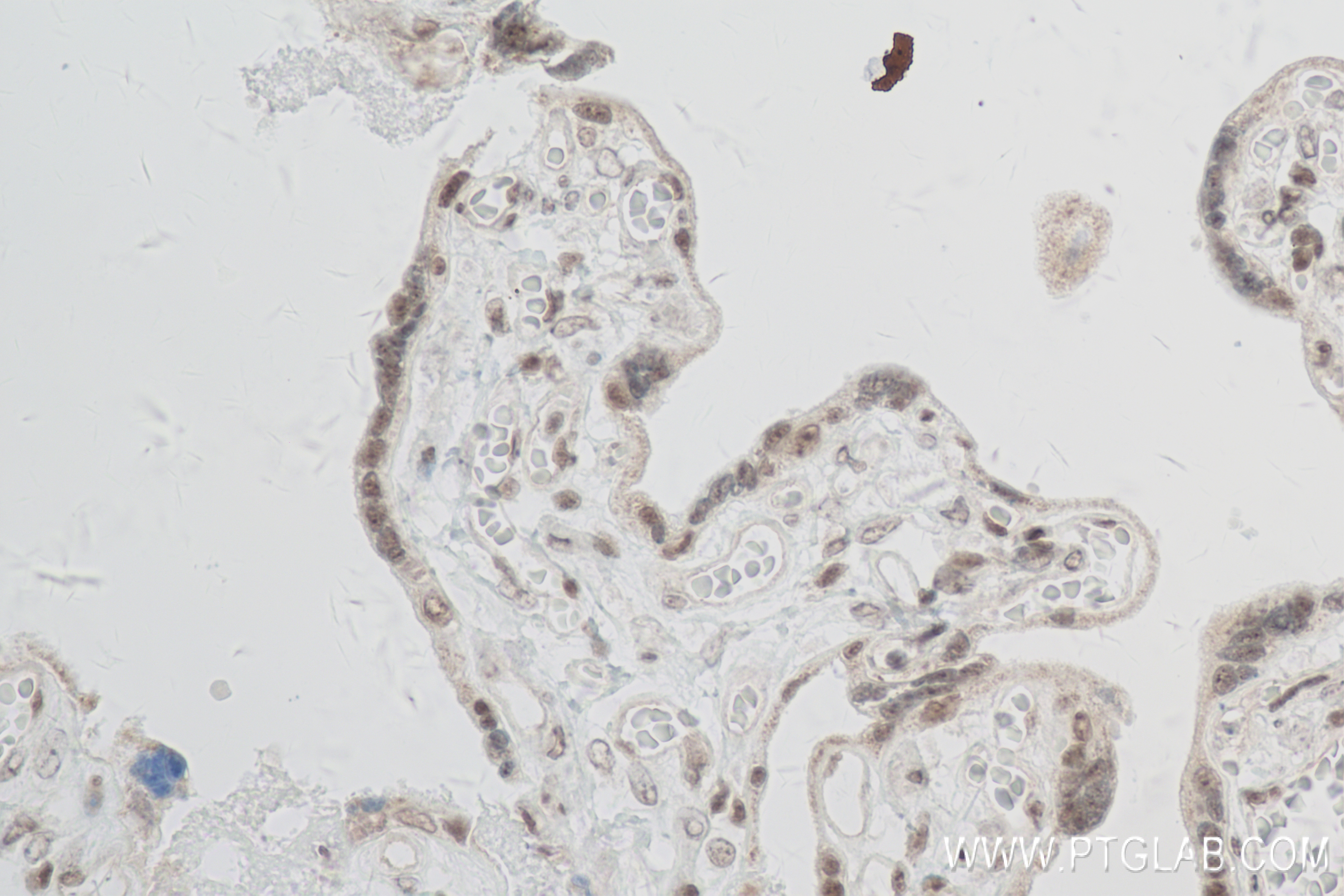 Immunohistochemistry (IHC) staining of human placenta tissue using RNGTT Recombinant antibody (83974-4-RR)