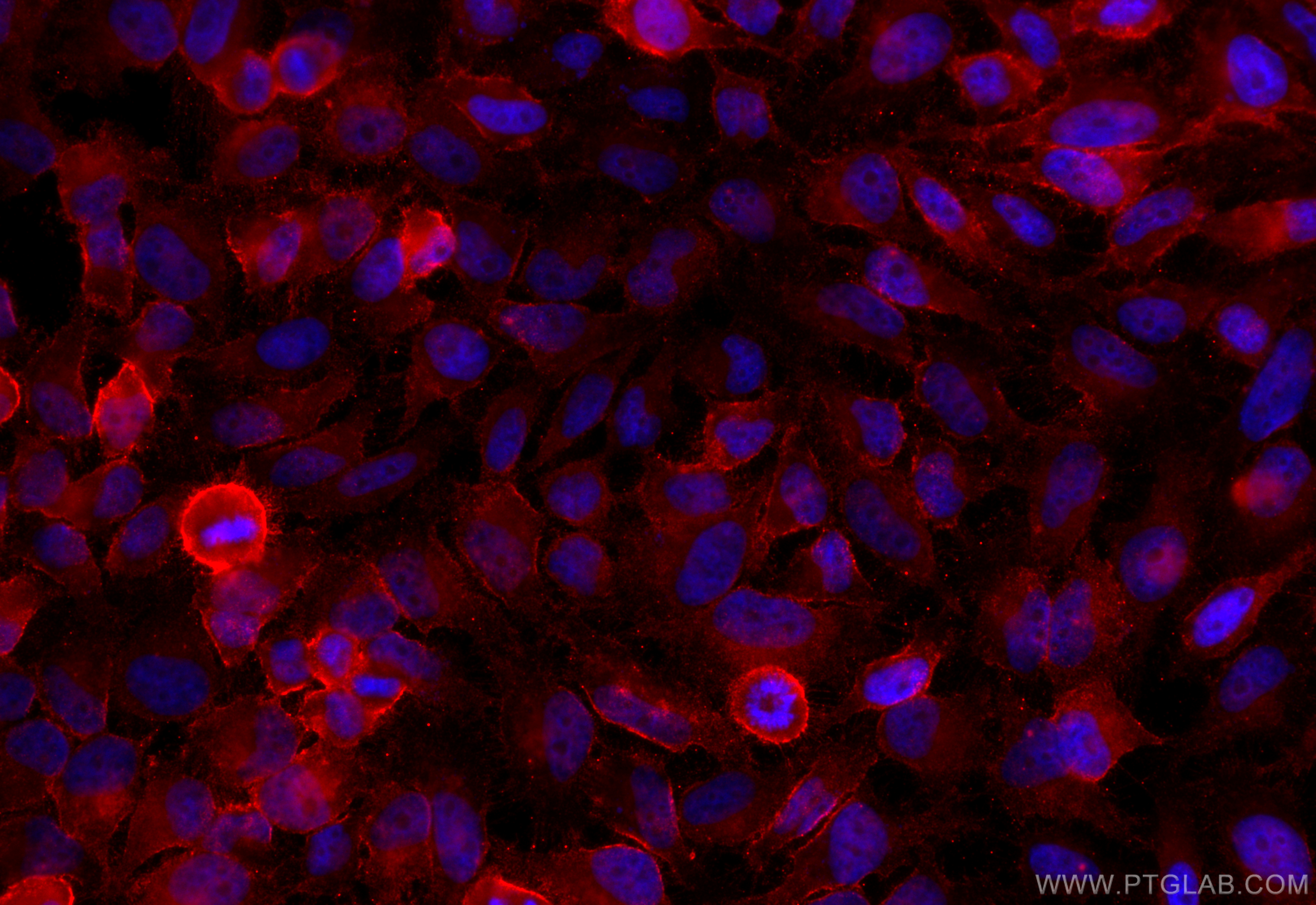 Immunofluorescence (IF) / fluorescent staining of HeLa cells using ROBO1 Polyclonal antibody (25181-1-AP)