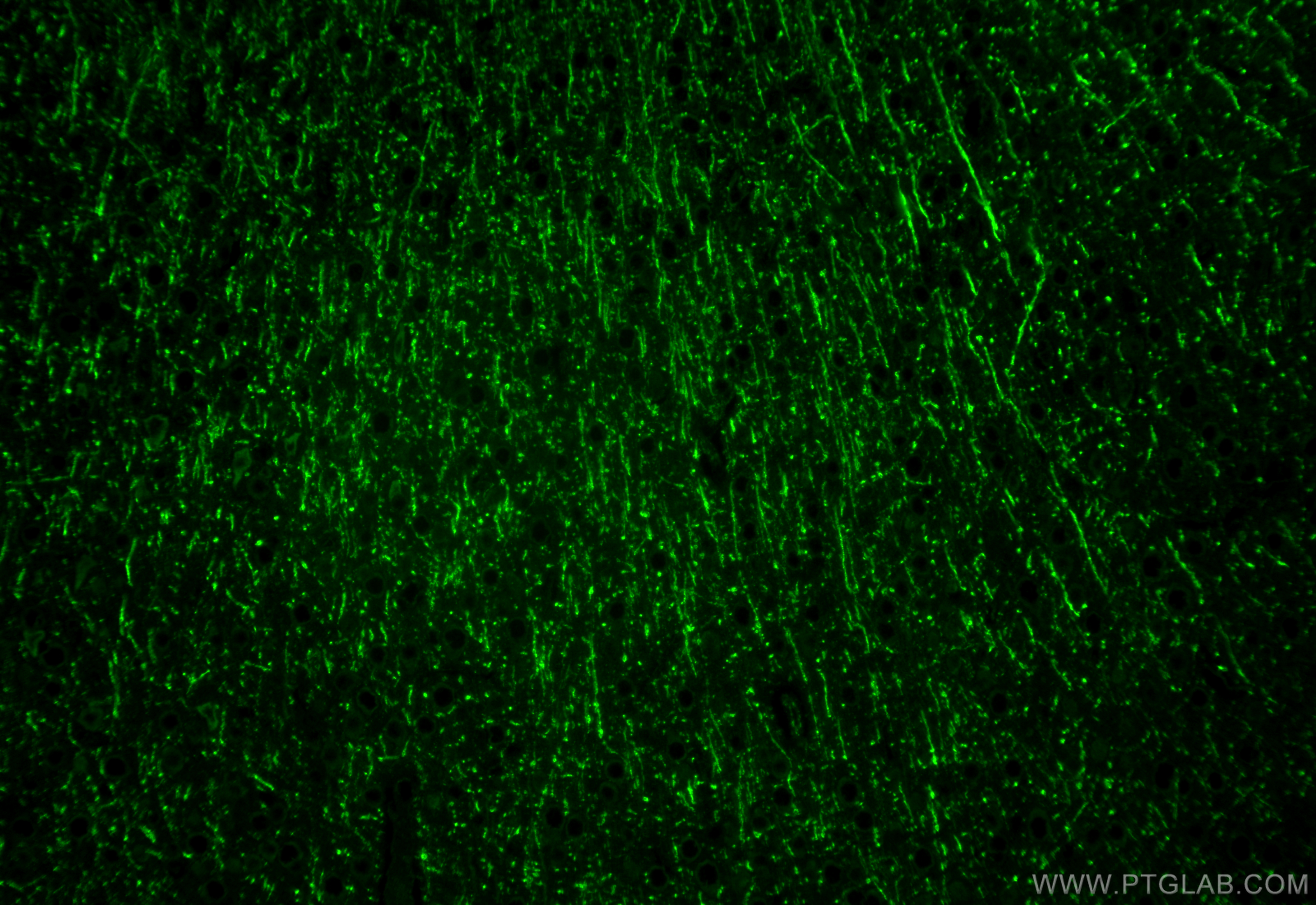 Immunofluorescence (IF) / fluorescent staining of mouse brain tissue using ROBO1 Polyclonal antibody (25181-1-AP)