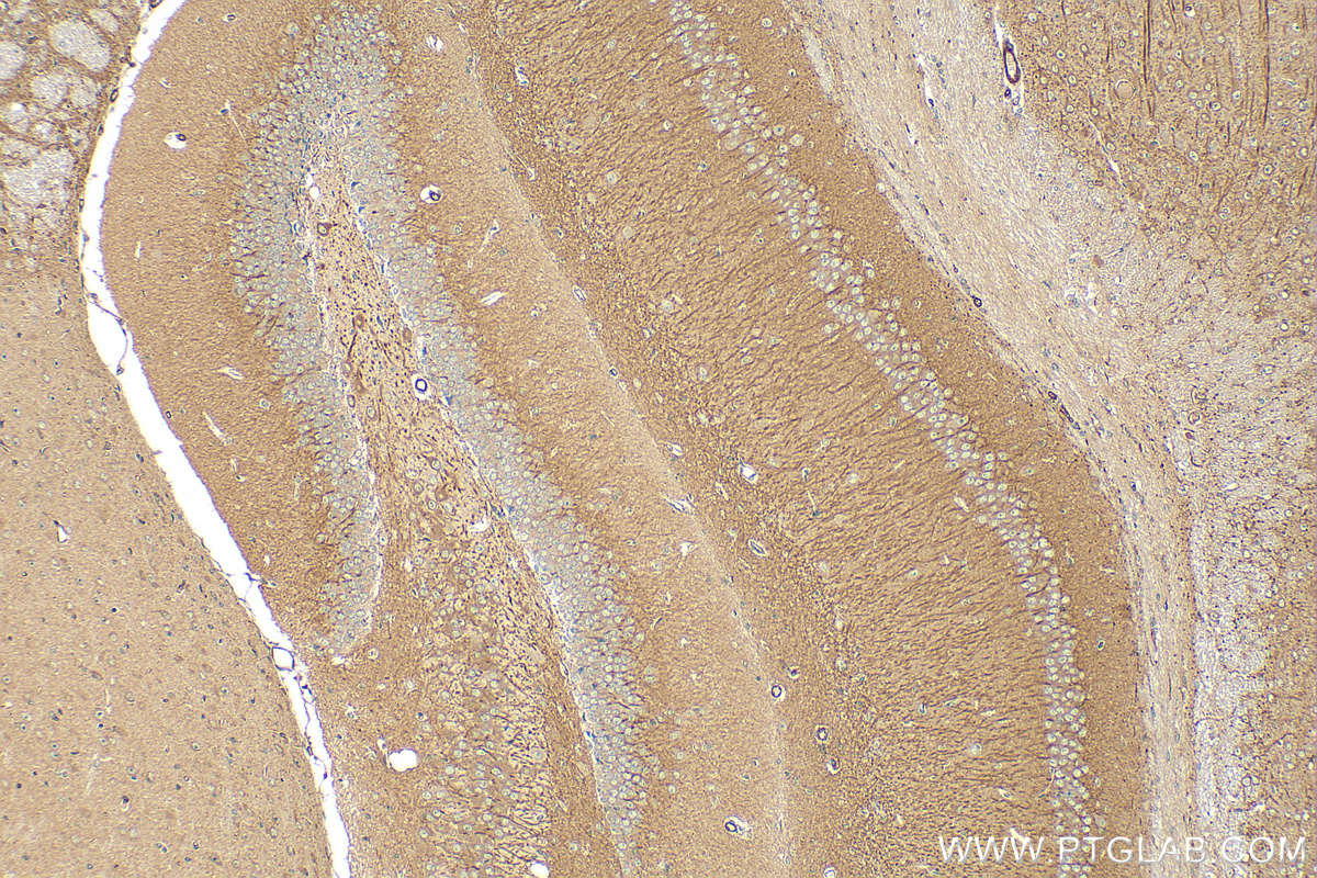 Immunohistochemistry (IHC) staining of mouse brain tissue using ROBO1 Polyclonal antibody (25181-1-AP)