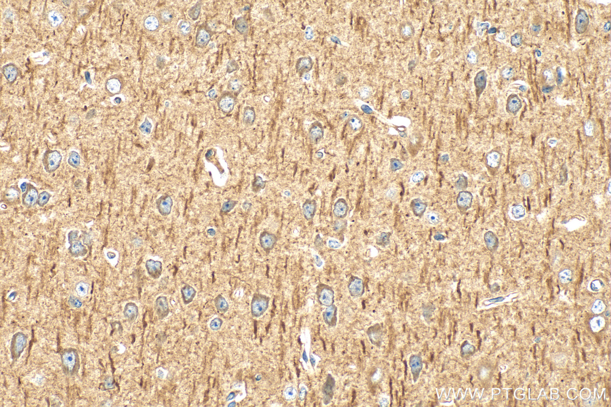 Immunohistochemistry (IHC) staining of mouse brain tissue using ROBO1 Polyclonal antibody (25181-1-AP)