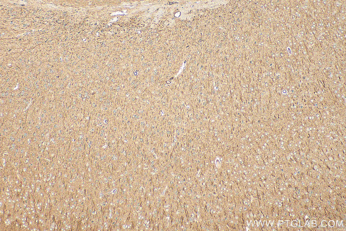 Immunohistochemistry (IHC) staining of mouse brain tissue using ROBO1 Polyclonal antibody (25181-1-AP)