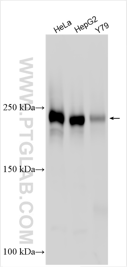 Western Blot (WB) analysis of various lysates using ROBO1 Polyclonal antibody (25181-1-AP)