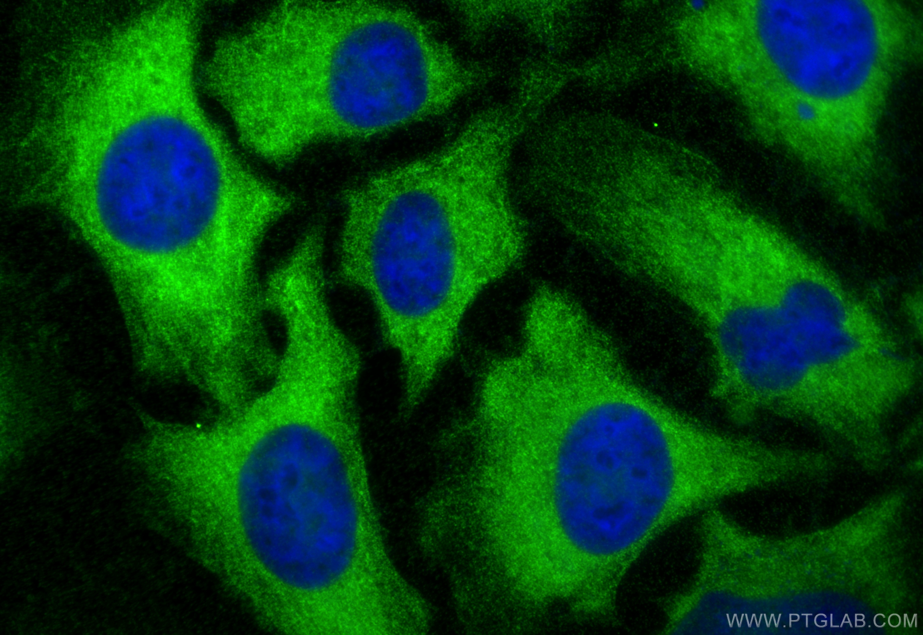 Immunofluorescence (IF) / fluorescent staining of HeLa cells using ROCK1 Polyclonal antibody (21850-1-AP)