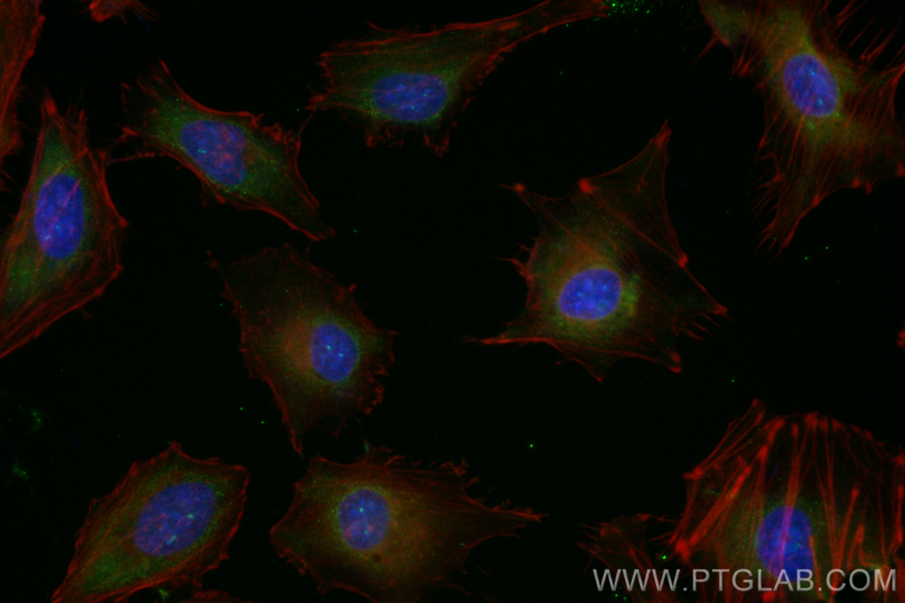 Immunofluorescence (IF) / fluorescent staining of HeLa cells using CoraLite® Plus 488-conjugated ROCK1 Recombinant an (CL488-83166-5)