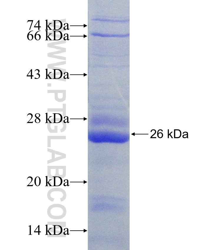 ROR2 fusion protein Ag31197 SDS-PAGE