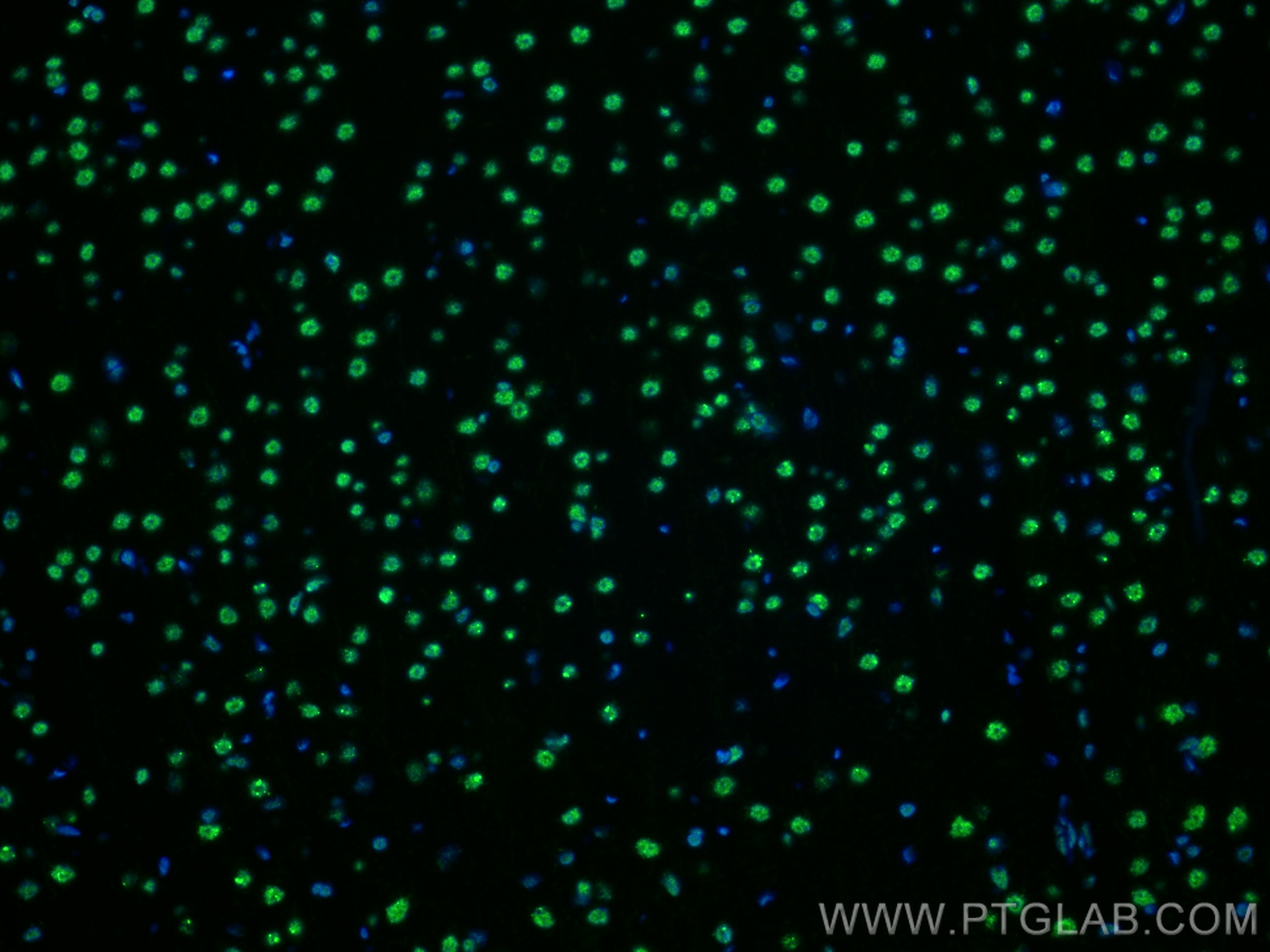 Immunofluorescence (IF) / fluorescent staining of rat brain tissue using RORA Recombinant antibody (82930-1-RR)