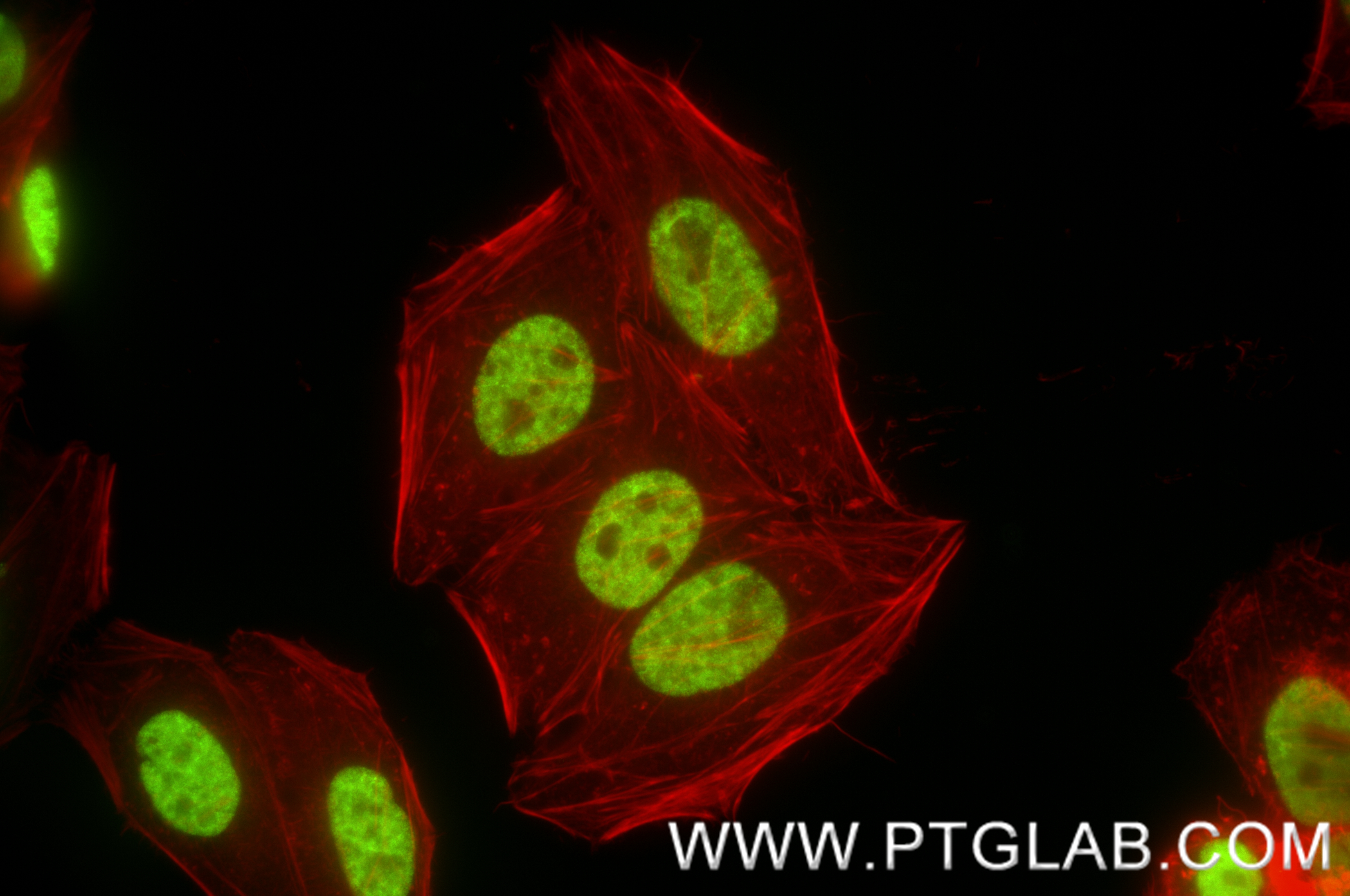 Immunofluorescence (IF) / fluorescent staining of HepG2 cells using RORA Recombinant antibody (82930-1-RR)
