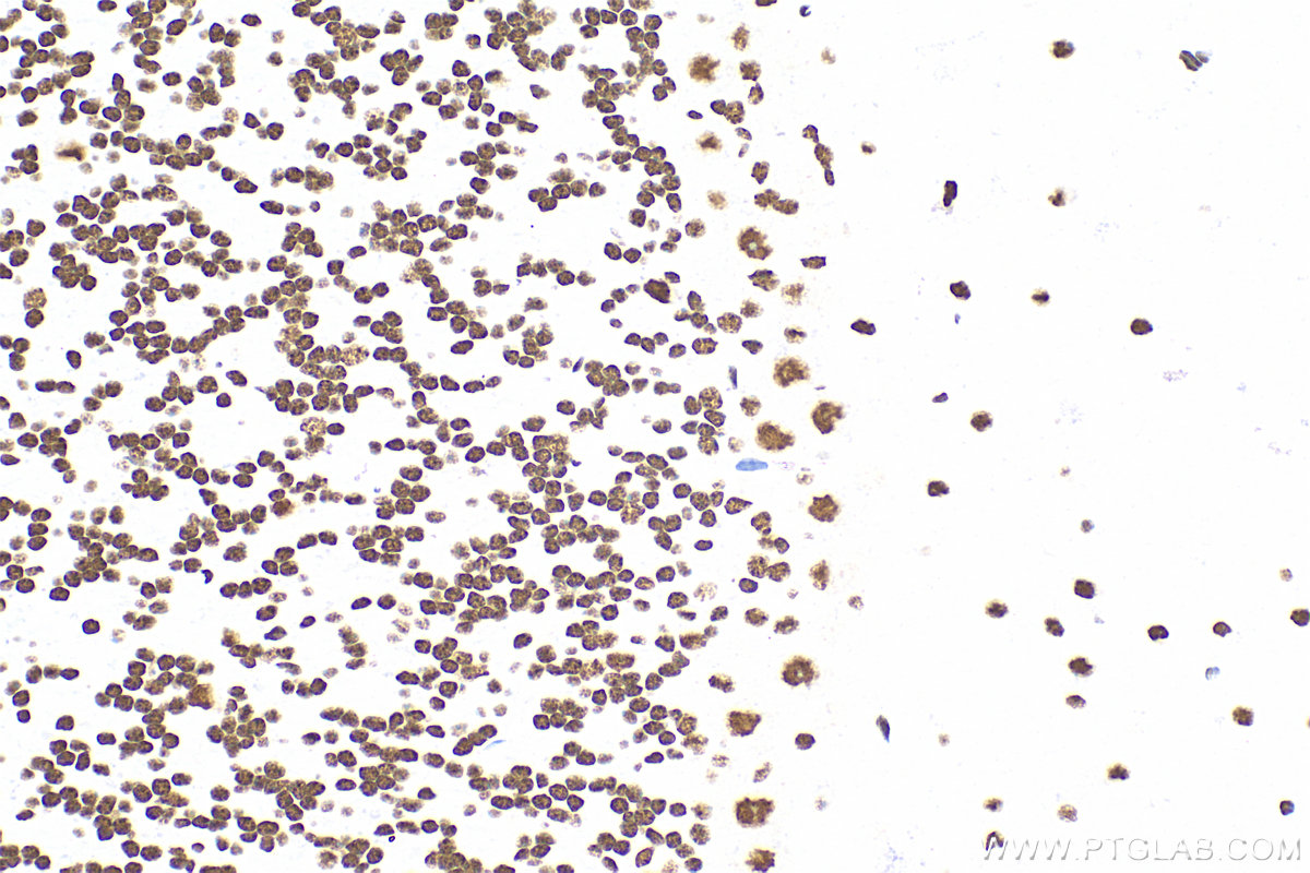 Immunohistochemistry (IHC) staining of mouse cerebellum tissue using RORA Recombinant antibody (82930-1-RR)