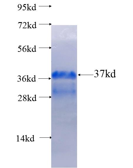 ROS1 fusion protein Ag25722 SDS-PAGE