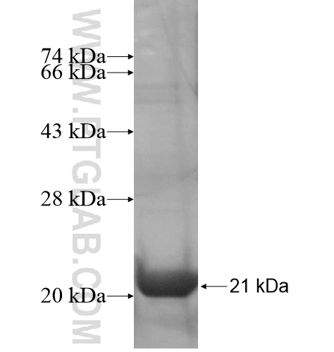 RP11-257K9.7 fusion protein Ag14686 SDS-PAGE