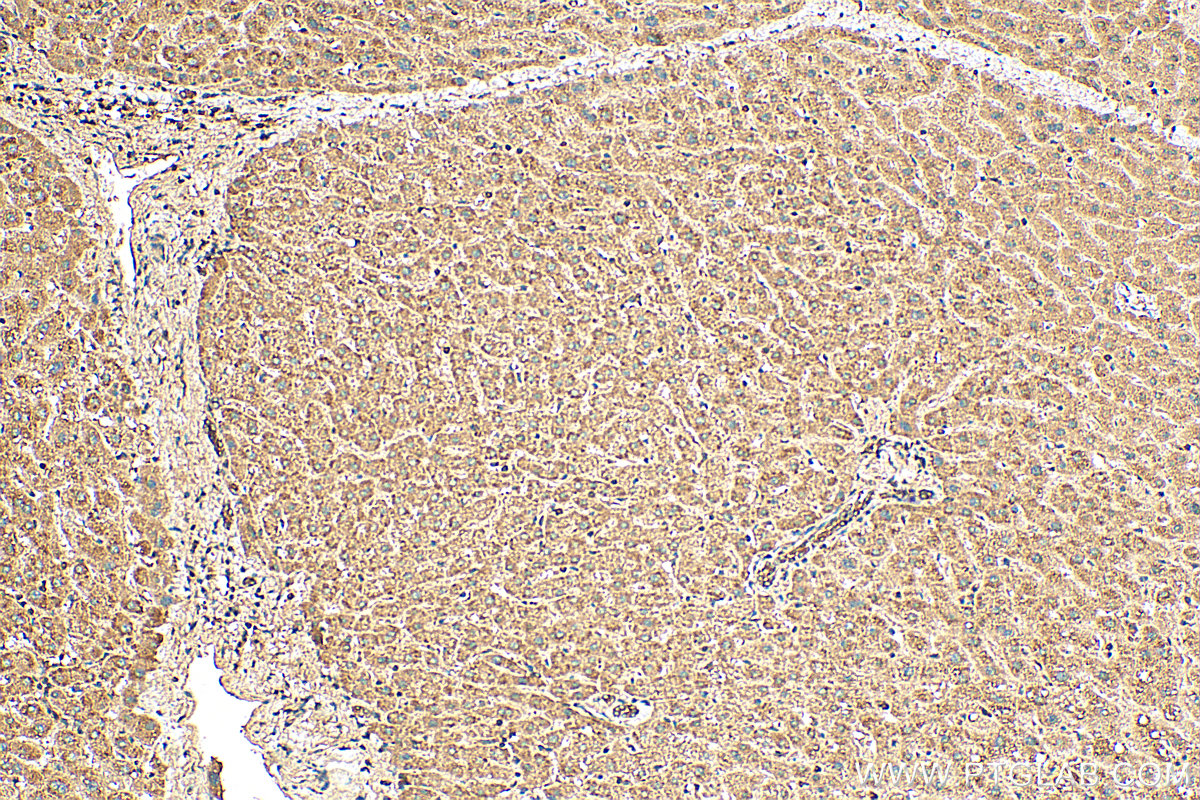 Immunohistochemistry (IHC) staining of human liver tissue using MST4 Polyclonal antibody (10847-1-AP)