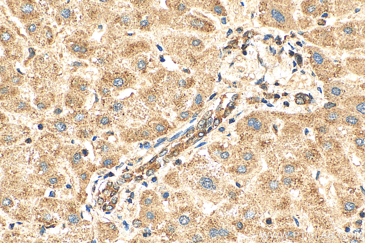 Immunohistochemistry (IHC) staining of human liver tissue using MST4 Polyclonal antibody (10847-1-AP)