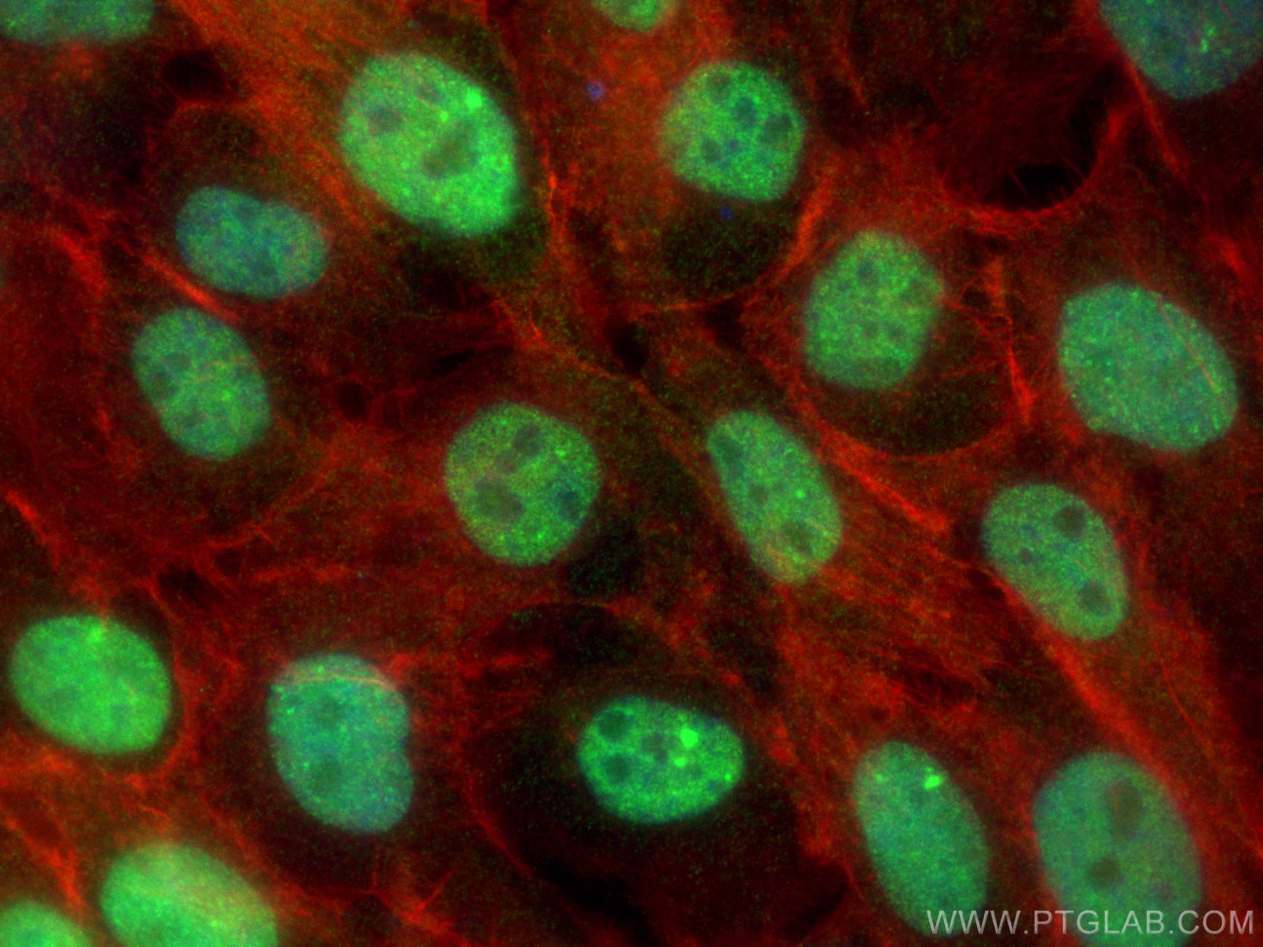 Immunofluorescence (IF) / fluorescent staining of A431 cells using RPA2 Polyclonal antibody (10412-1-Ap)