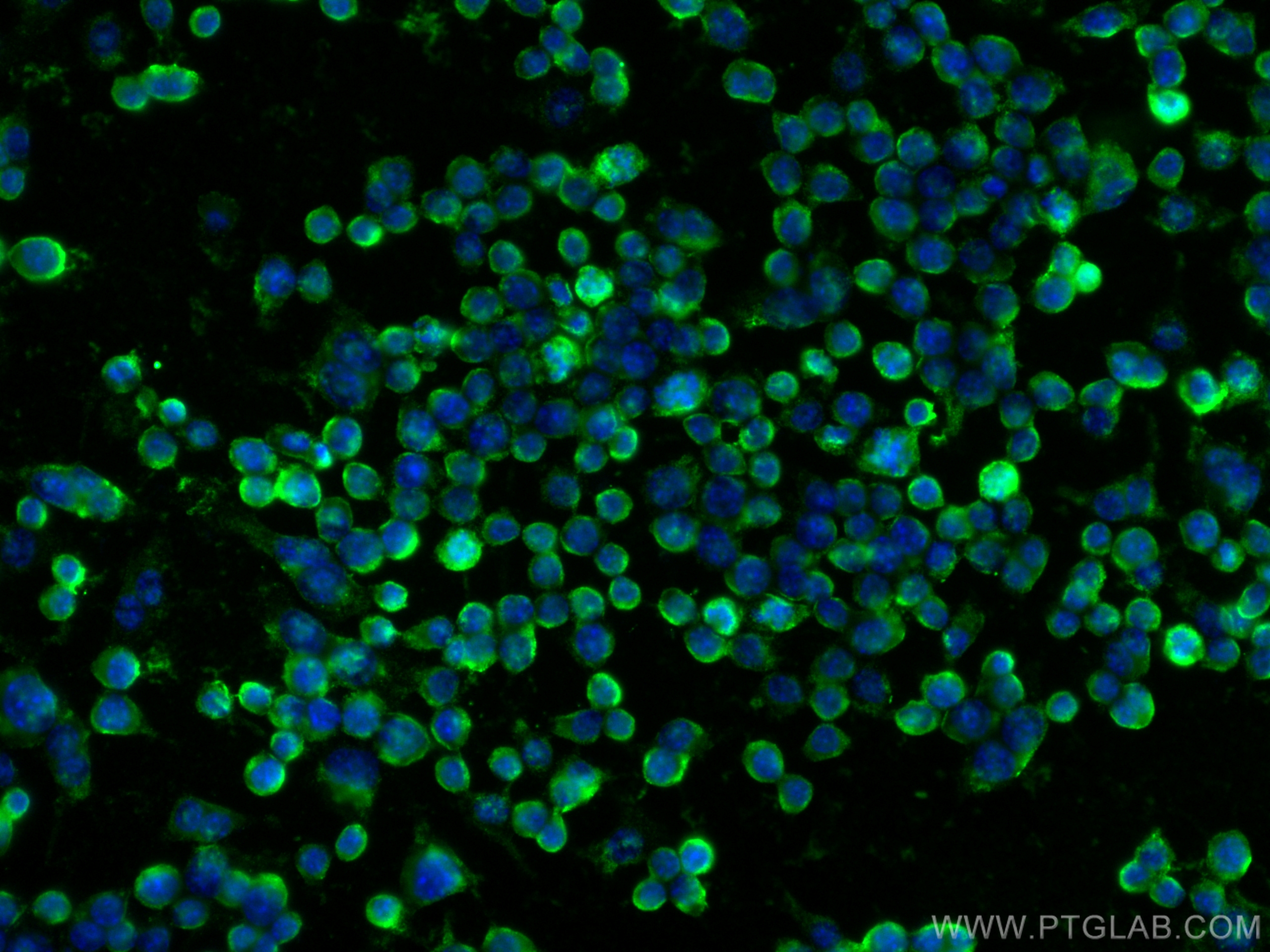 Immunofluorescence (IF) / fluorescent staining of RAW 264.7 cells using RPE Polyclonal antibody (12168-2-AP)